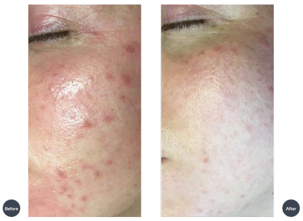 Mandala Premium Lift Facial Cleansing - Image 3